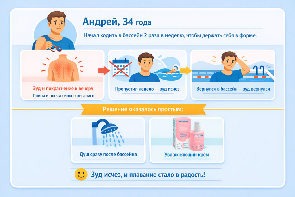 достаточно-двух-изменений-в-привычках-принимать-душ-сразу-после-выхода-из-воды-и-наносить-увлажняющий-крем зуд-после-бассейна